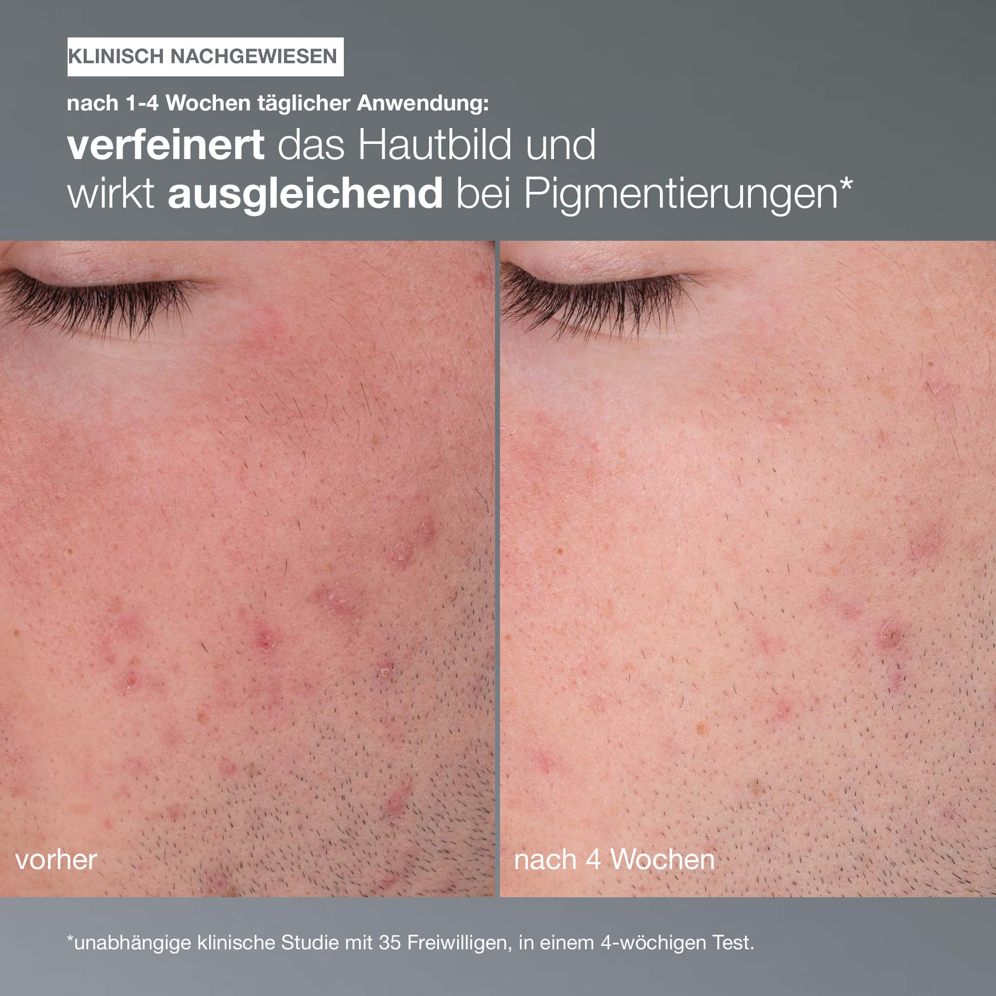 Daily Microfoliant - Image 11