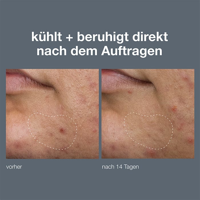 Deep Breakout Liquid Patch - Image 5
