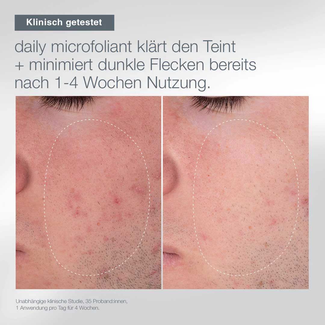 Limited Edition - Daily Microfoliant - Image 4