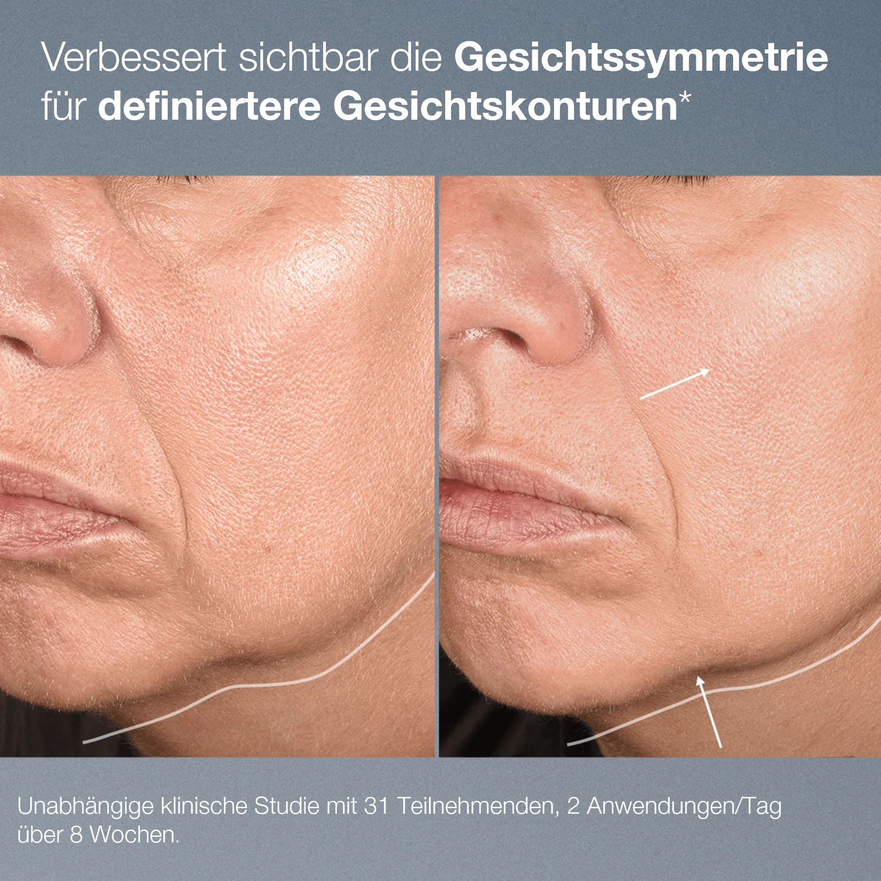 NeuroTouch Symmetry Serum - Image 9