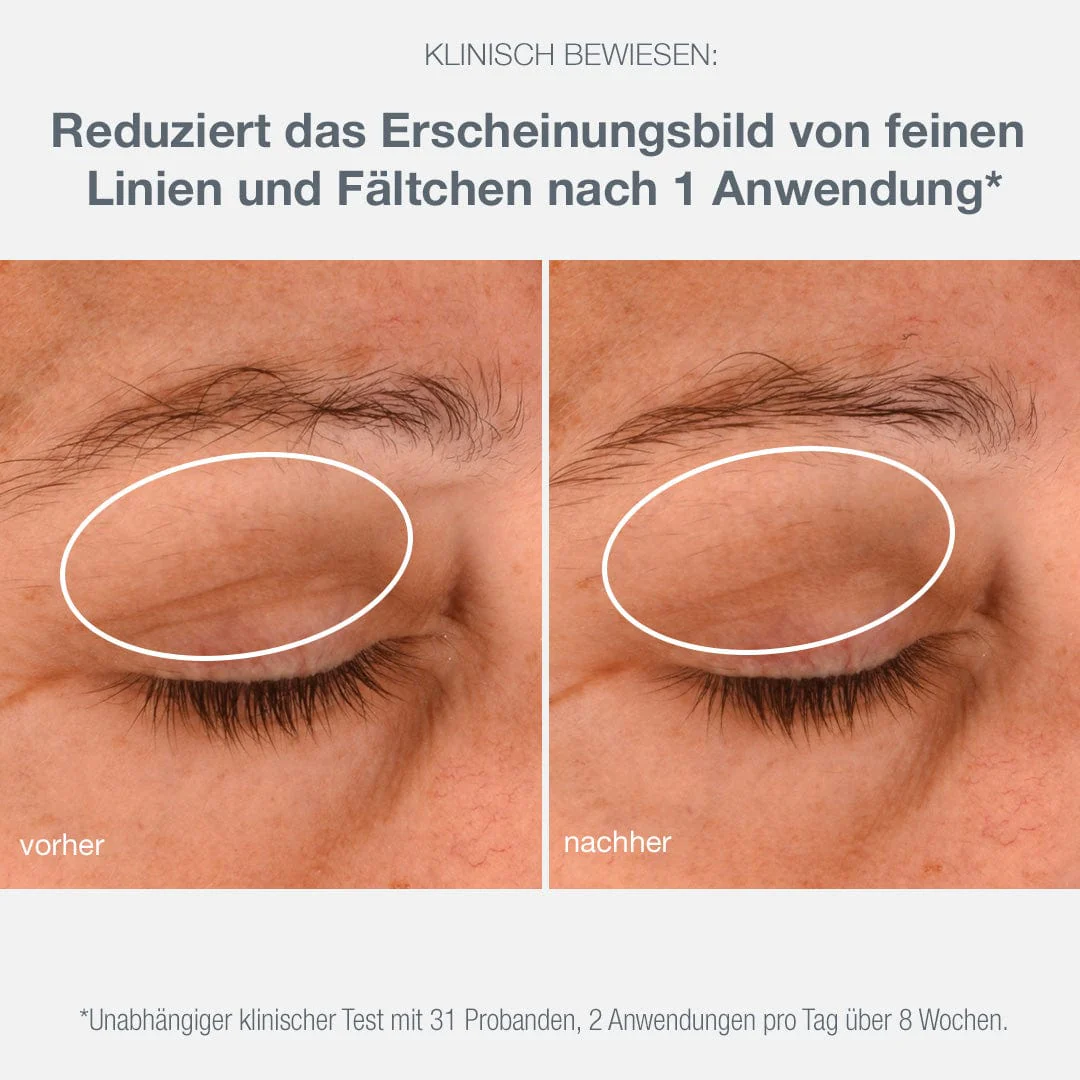 Phyto Nature e² Exosom Treatment + Phyto Nature Lifting Eye Cream - Image 20