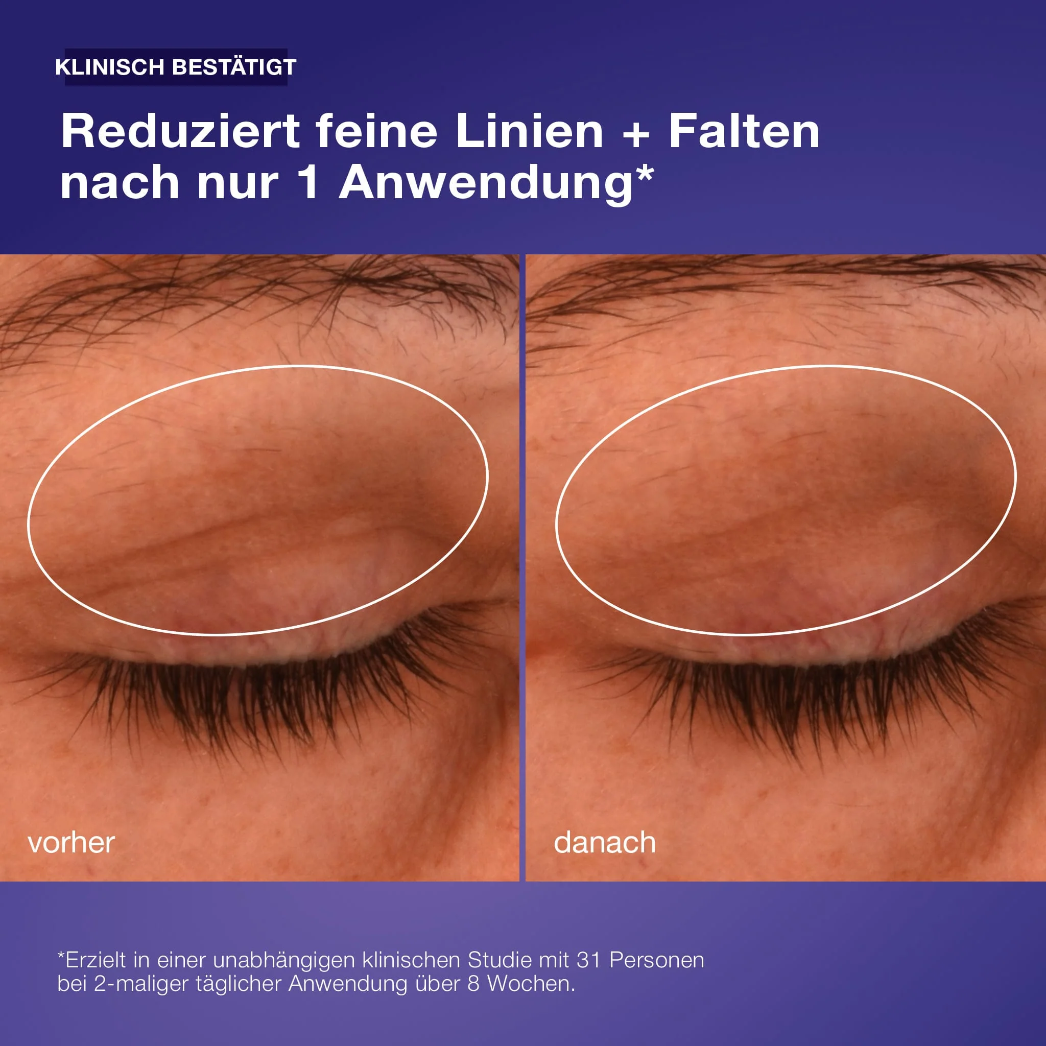 Phyto Nature Lifting Eye Cream - Image 5