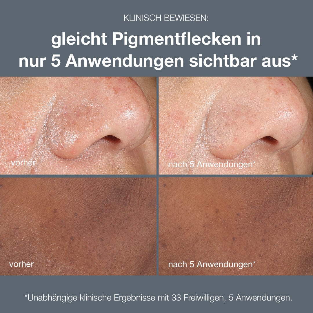 PowerBright Dark Spot Peel - Image 5