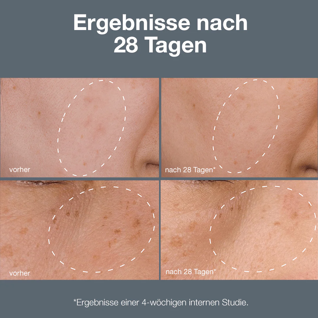 Powerbright Dark Spot System - Image 4
