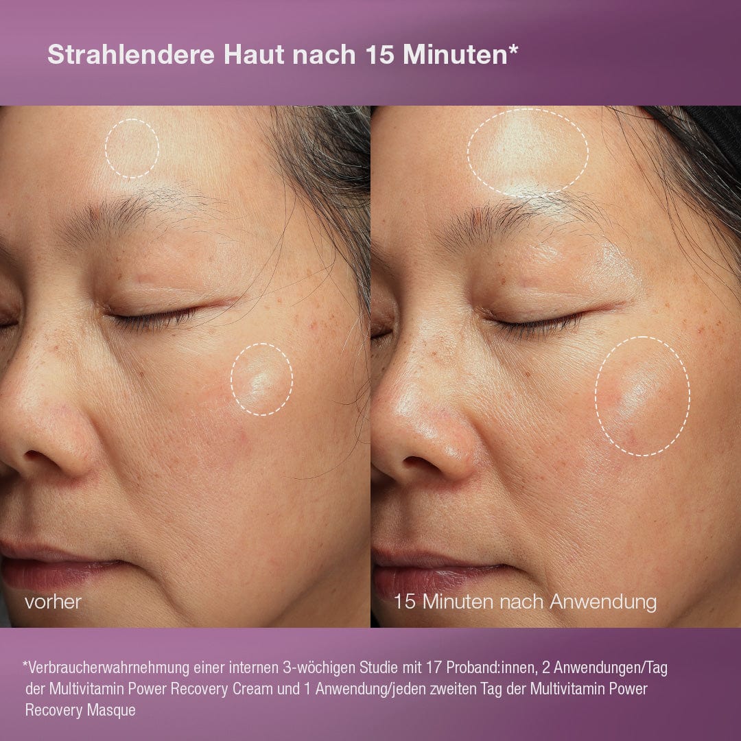 Stressed Skin Recovery System - Image 3